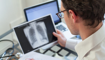 Community-acquired Pneumonia