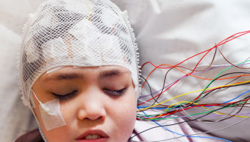 Epilepsy Management