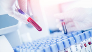 Testing, Testing, 1,2,3 - Rational pathology testing in general practice